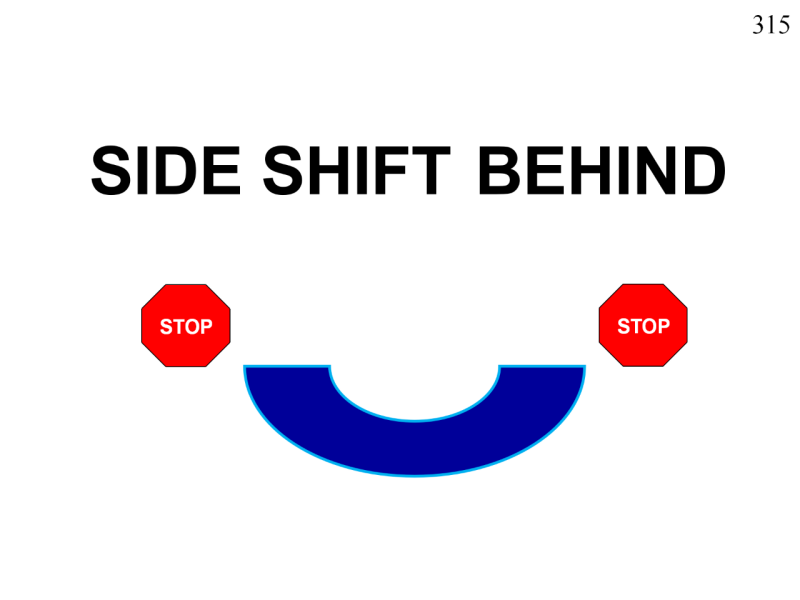 11-315.png